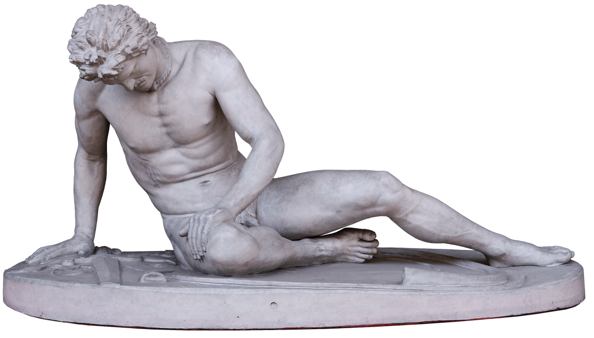 «Умирающий Галл» (Рим, Капитолийский музей),