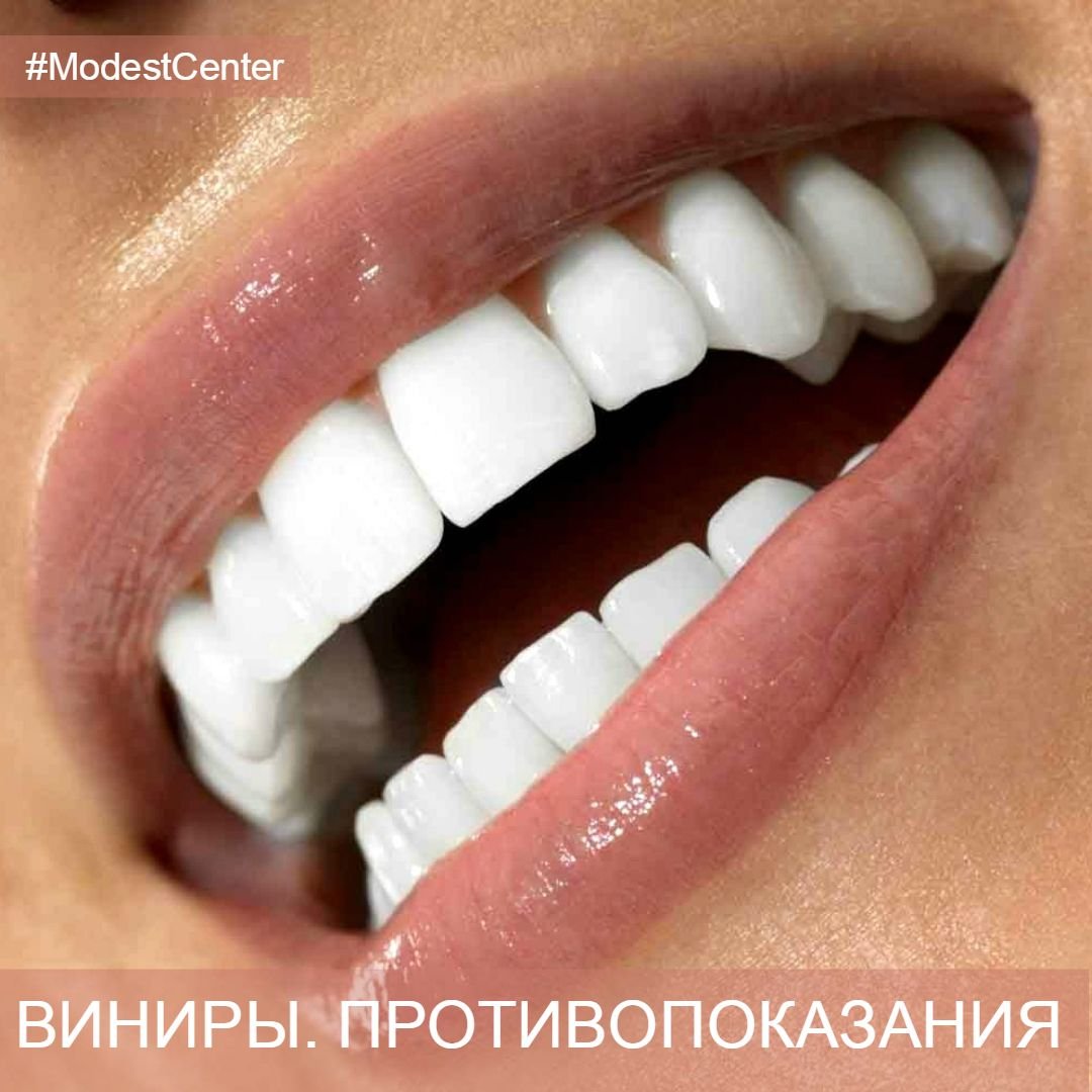 Самые красивые зубы