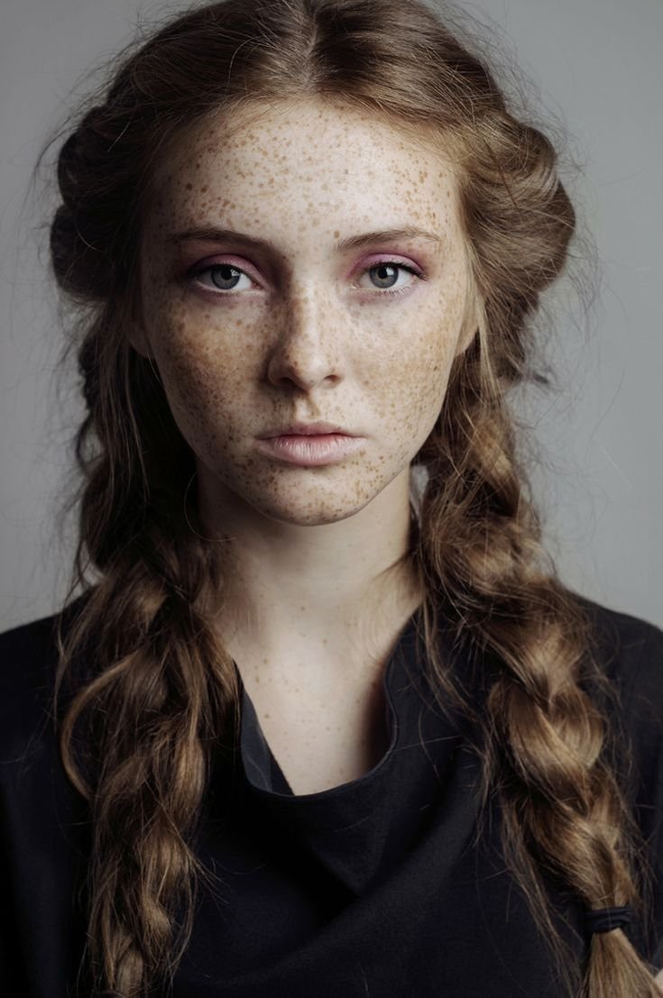 Freckles Оливия
