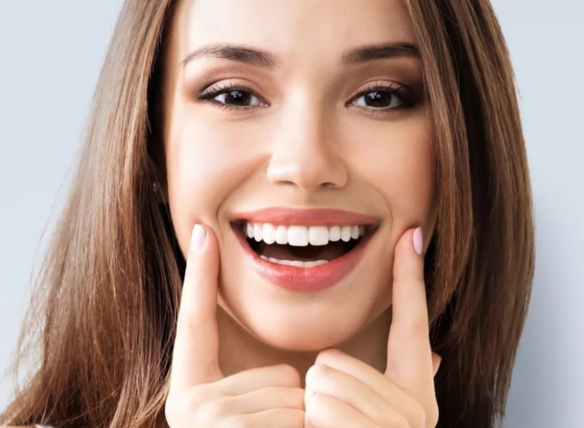 TRUSMILE Veneers