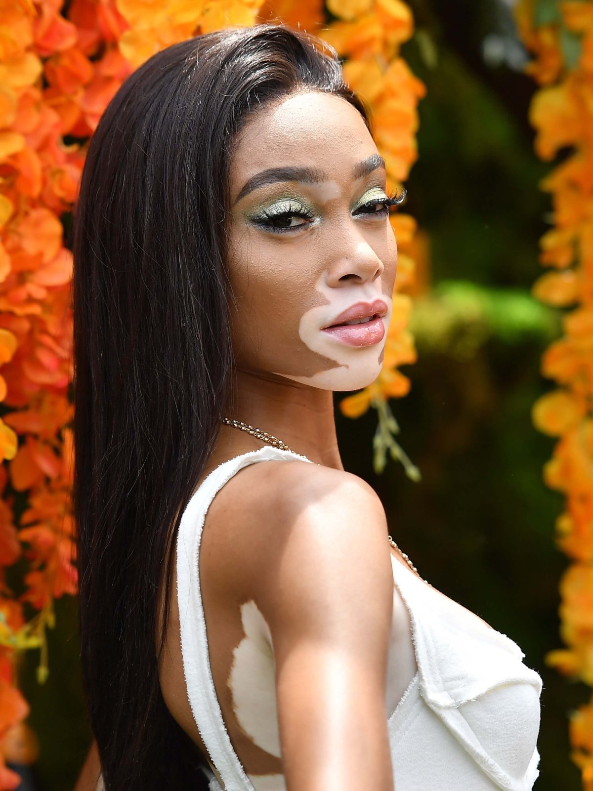 Winnie Harlow