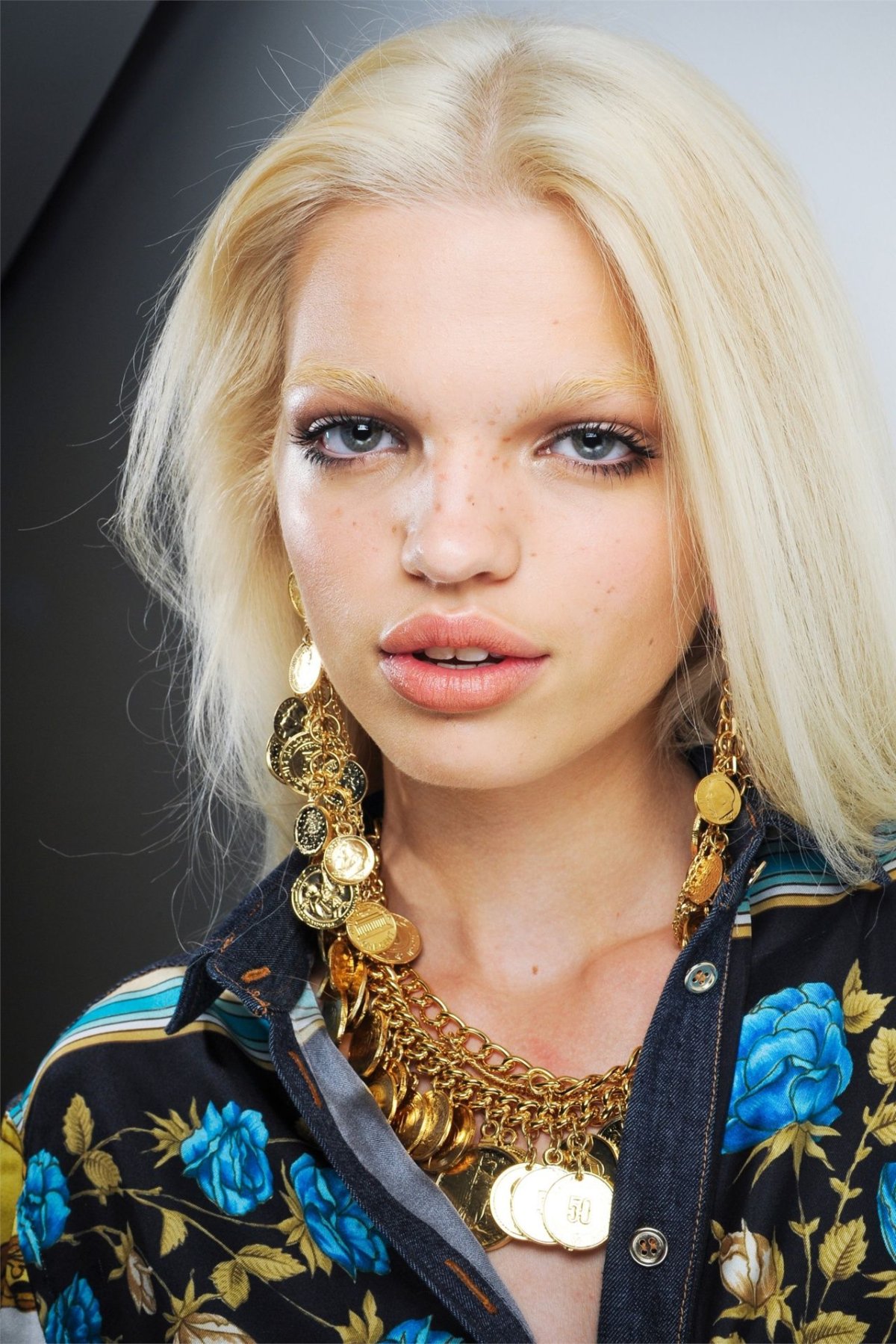 Daphne Groeneveld до пластики